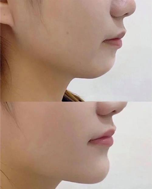 中山奢颜立整形医院是正规医院吗?