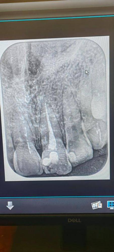 义乌至尚口腔特色项目及技术优势