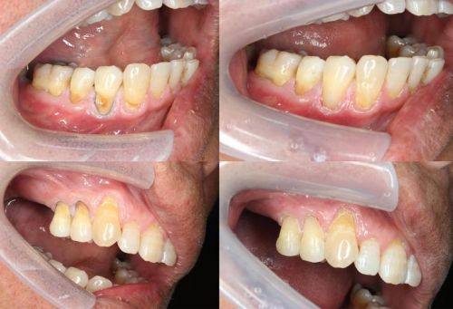 重庆忠县徐勇口腔地址电话营业时间