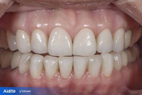 大同恒大口腔详细的预约挂号方式及流程