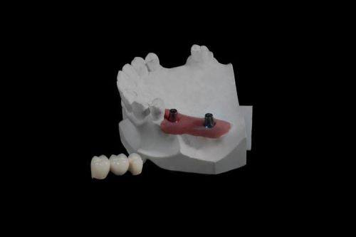 重庆忠县徐勇口腔真人口碑评价怎么样?