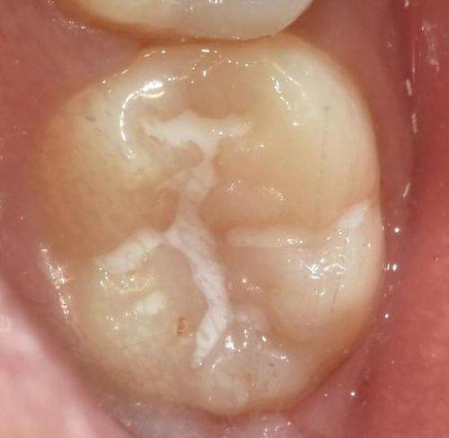 重庆忠县徐勇口腔详细的预约挂号方式及流程