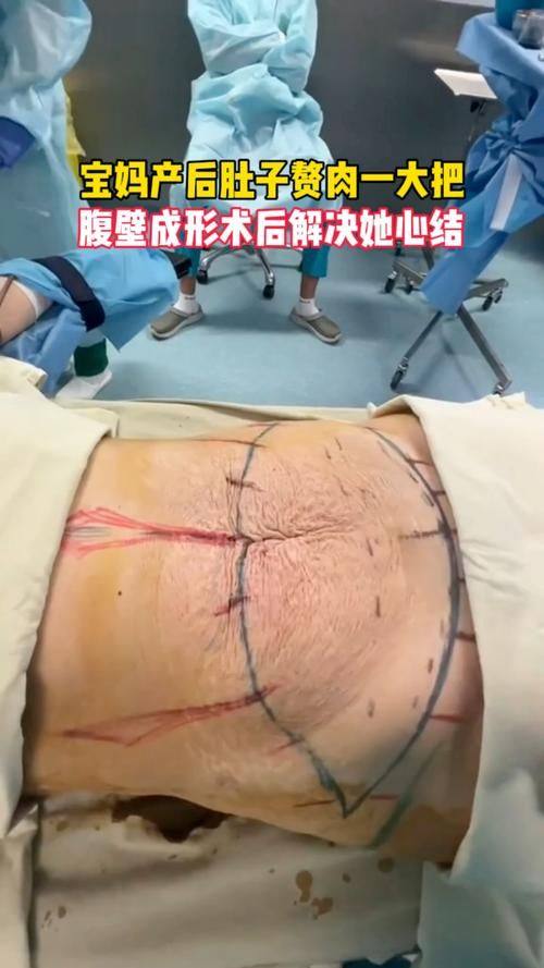 广州紫馨整形外科医院医生团队实力强大及骨干医生简介