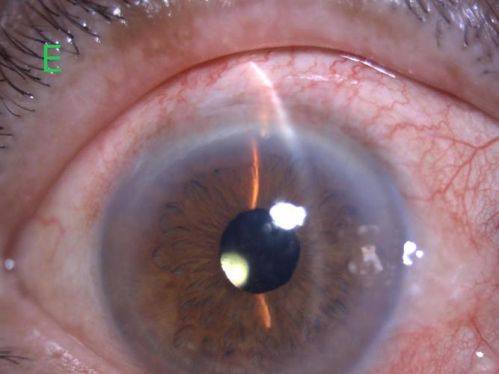 重庆市巴南区人民医院眼科简介概述