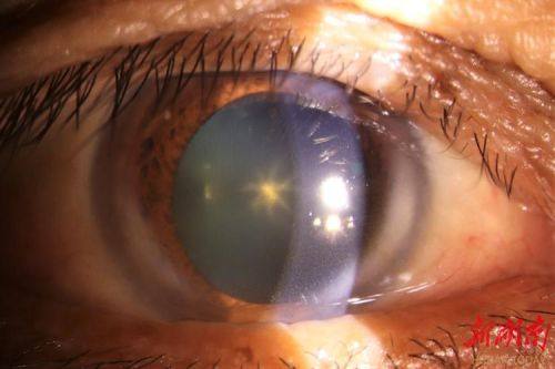 三河康仁眼科医院真人口碑评价怎么样?