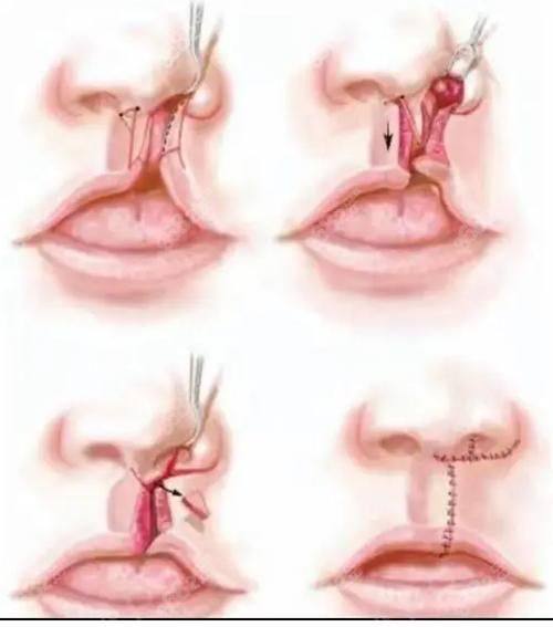 中山奢颜立整形医院详细的预约挂号方式及流程