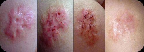 医院真人口碑评价怎么样？