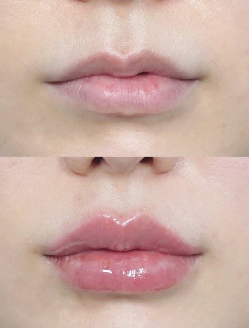 上海御美妍医疗美容门诊部是正规医院吗？