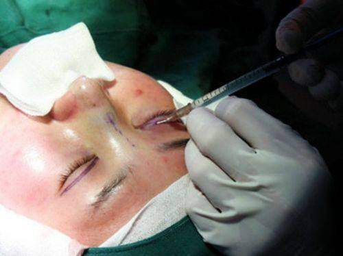 扬州丽致医疗美容门诊部详细的预约挂号方式及流程