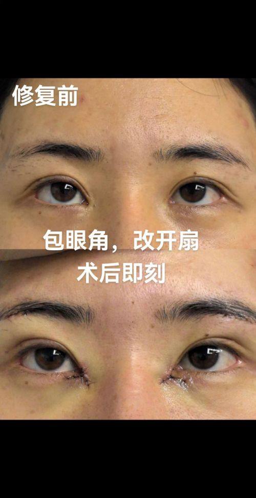 黔南州人民医院医疗美容科是正规医院吗？