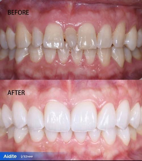 湖南怀化溆浦美来口腔收费价格表/收费标准