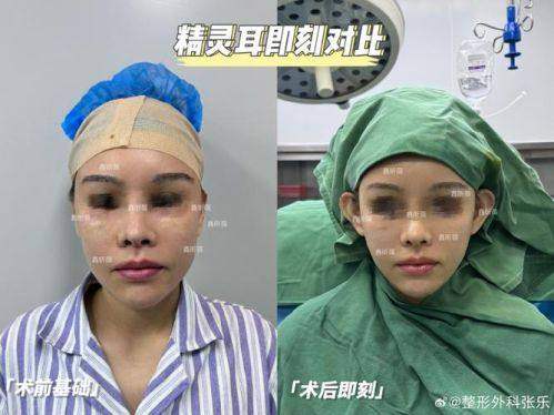 扬州丽致医疗美容门诊部真人口碑评价怎么样？