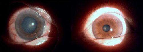 都昌县人民医院眼科特色项目及技术优势