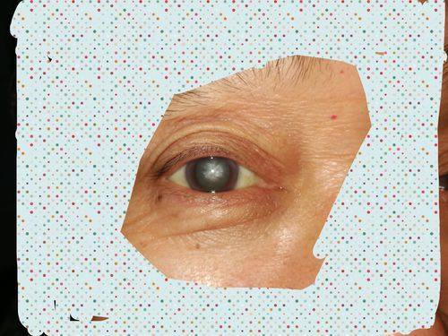 海口市第四人民医院眼科真人口碑评价怎么样？