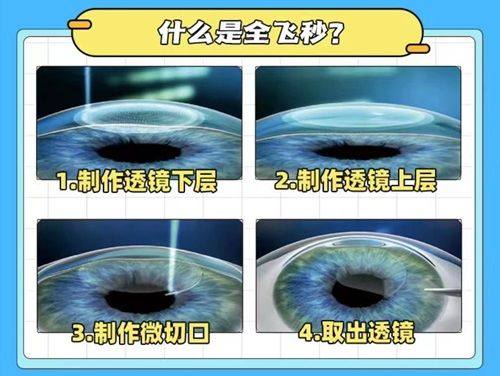 广州海得视近视矫正门诊部简介概述