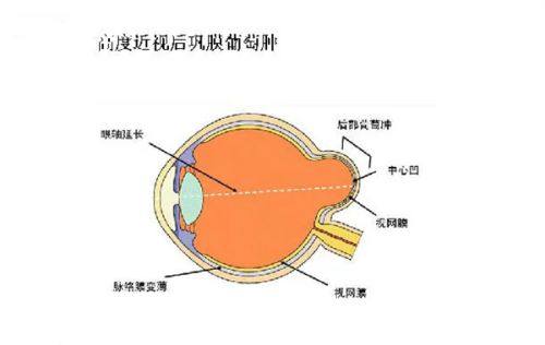 广州海得视近视矫正门诊部是正规医院吗？