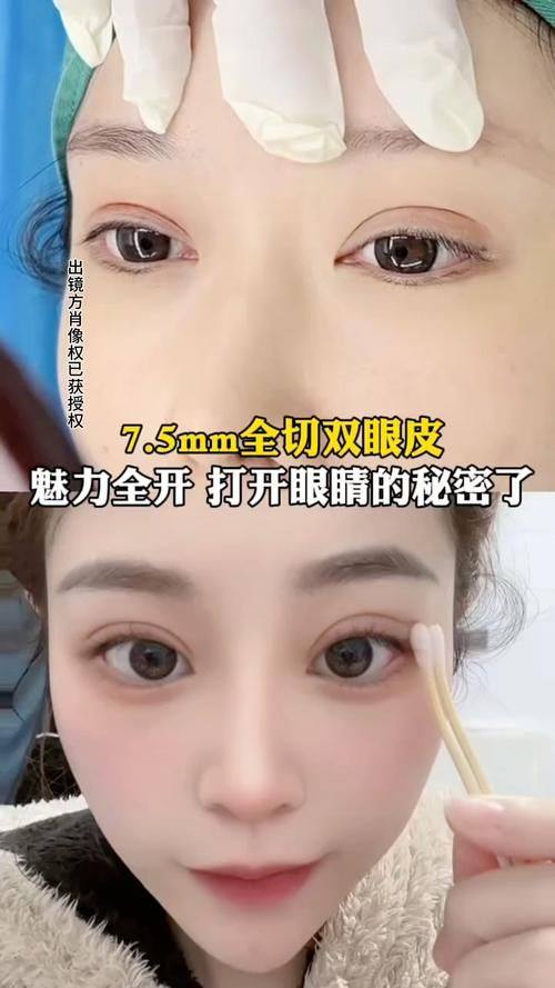 肇庆华美整形美容医院是正规医院吗？