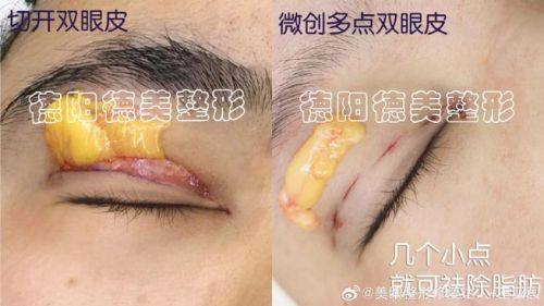 苏州心妍美整形医院特色项目及技术优势