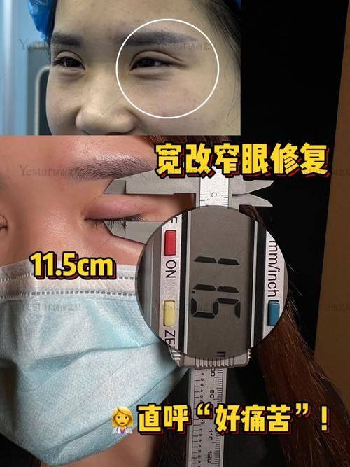 肇庆华美整形美容医院收费价格表/收费标准