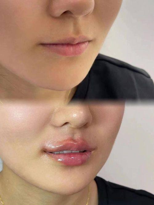 韩国The Cell皮肤科江南本店详细的预约挂号方式及流程