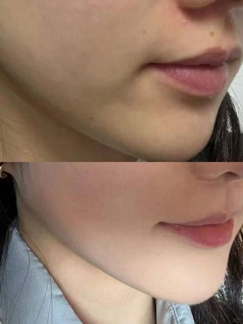 韩国The Cell皮肤科江南本店地址电话营业时间