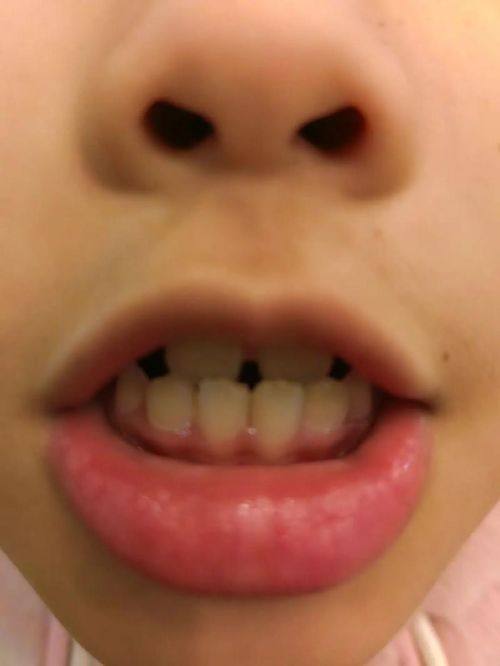 重庆八益口腔医院是正规医院吗？