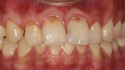 东莞麻涌维尔口腔门诊部收费价格表/收费标准