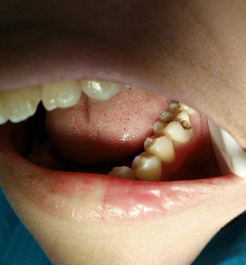 北京瑞鲨口腔(公主坟/万寿路分院)是正规医院吗？