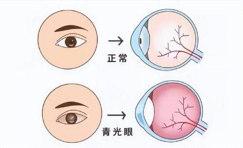 宝鸡市人民医院眼科是正规医院吗？