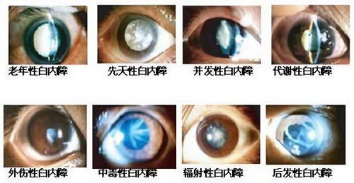 宝鸡市人民医院眼科收费价格表/收费标准