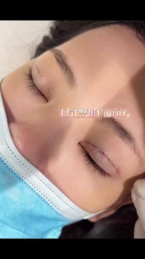 肇庆华美整形美容医院详细的预约挂号方式及流程