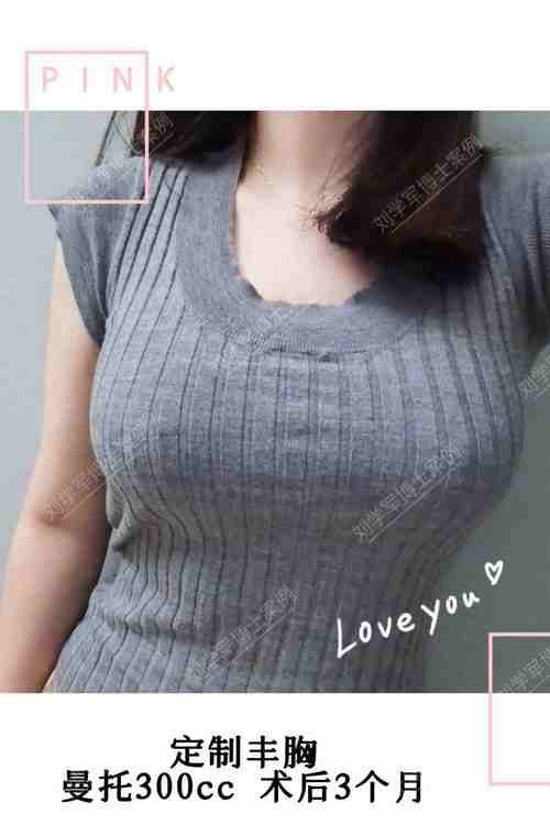 苏州心妍美整形医院真人口碑评价怎么样？