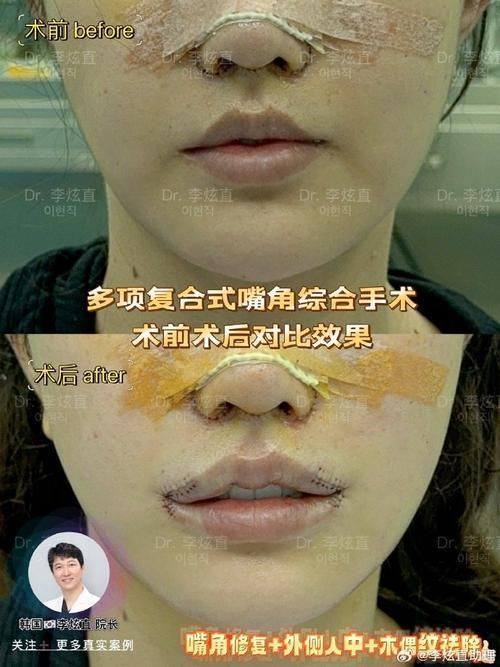 济南韩漾整形医院真人口碑评价怎么样？