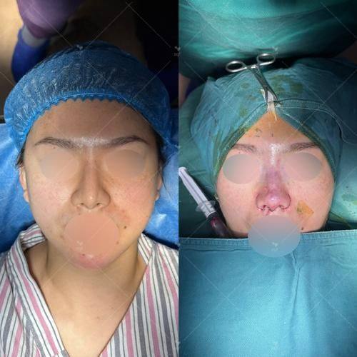 肇庆华美整形美容医院特色项目及技术优势