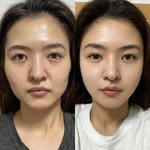 济南韩漾整形医院详细的预约挂号方式及流程