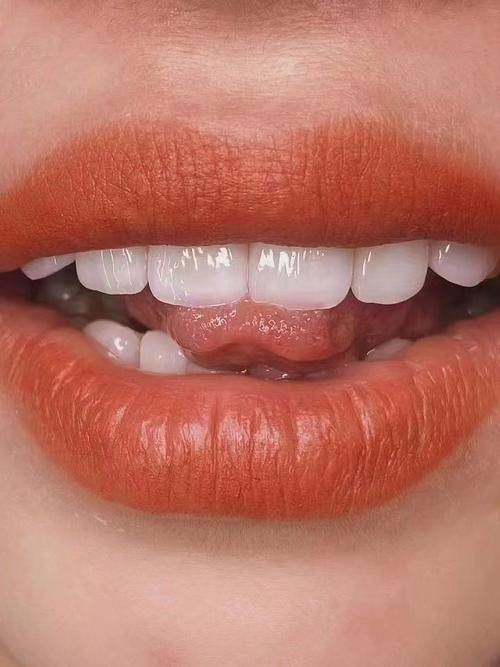 东莞麻涌维尔口腔门诊部详细的预约挂号方式及流程