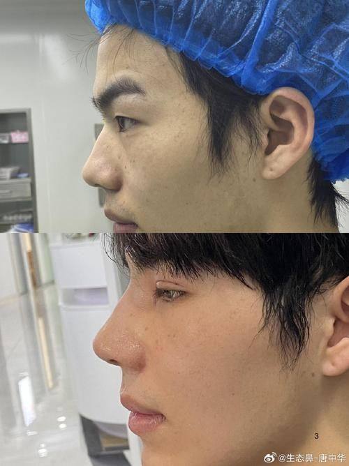 杭州和瑞医疗美容医院是正规医院吗？