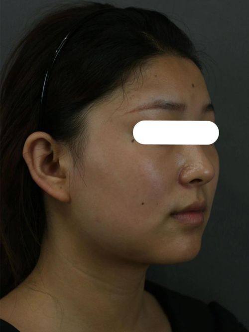 成都锦江今妃医学美容诊所特色项目及技术优势