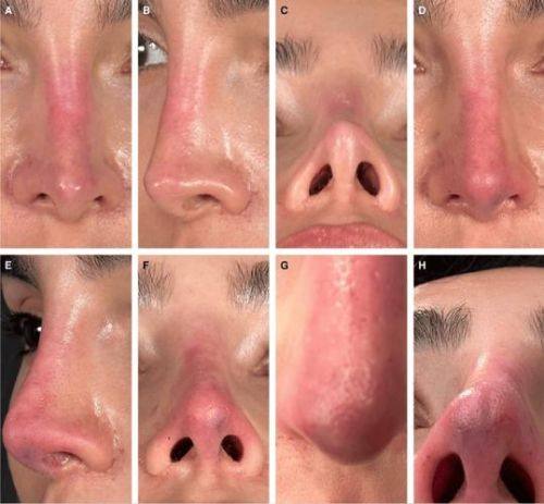 深圳尹医生整形美容中 心详细的预约挂号方式及流程