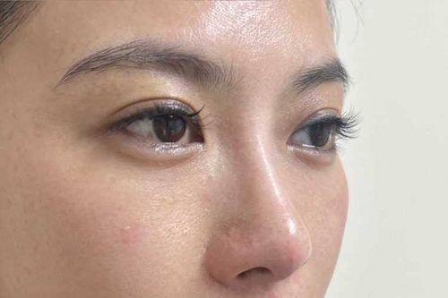 陕西同济整形美容医院真人口碑评价怎么样？