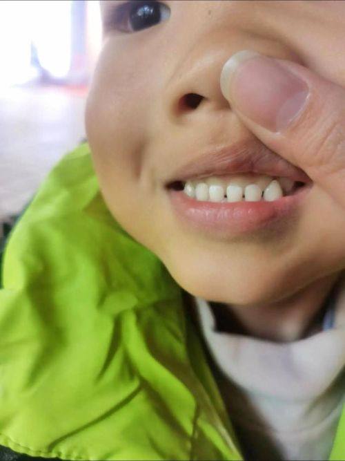 西安交大口腔医院详细的预约挂号方式及流程