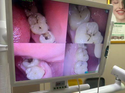 西安交大口腔医院特色项目及技术优势