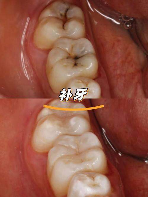 西安交大口腔医院收费价格表/收费标准