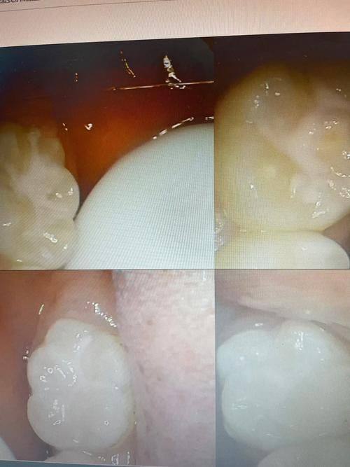 江苏盐城品尚口腔诊所是正规医院吗？