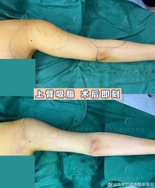 西双版纳悦她婕熹卡医疗美容门诊部特色项目及技术优势