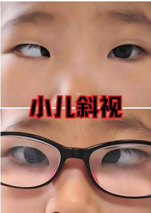 西安高陵太和综合医院眼科是正规医院吗？