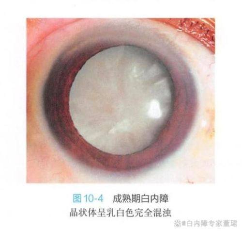 南昌华厦眼科医院详细的预约挂号方式及流程