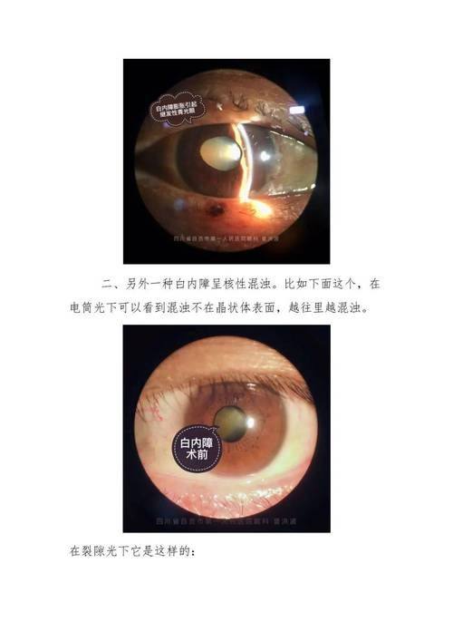 海南西部中 心医院眼科地址电话营业时间