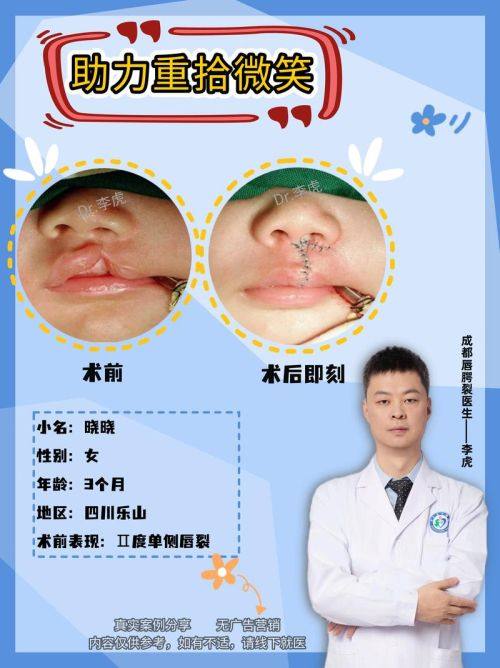 深圳尹医生整形美容中 心真人口碑评价怎么样？