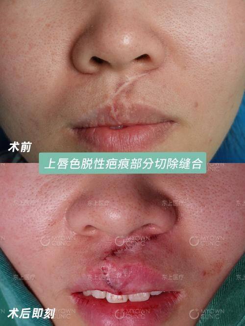 成都锦江今妃医学美容诊所收费价格表/收费标准